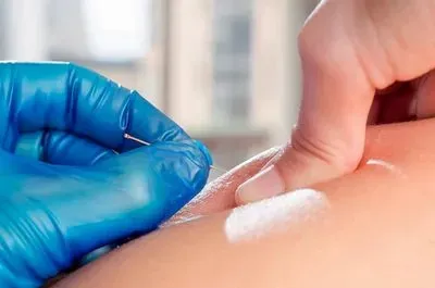 Precision IMS/Dry Needling & Therapy Essentials